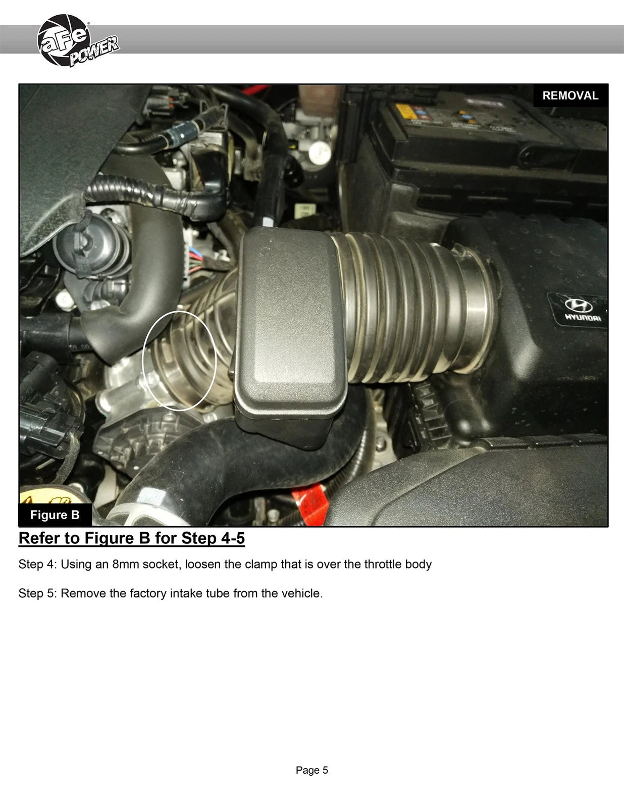 aFe Takeda Momentum Pro 5R Cold Air Intake System 16-20 Hyundai Elantra L4-2.0L